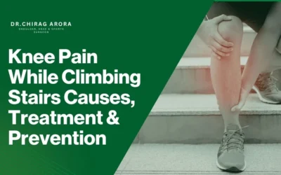 Knee Pain While Climbing Stairs Causes, Treatment & Prevention  