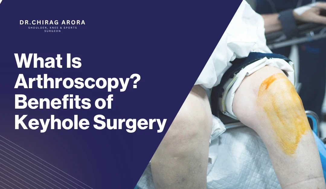 What Is Arthroscopy? Benefits of Keyhole Surgery 