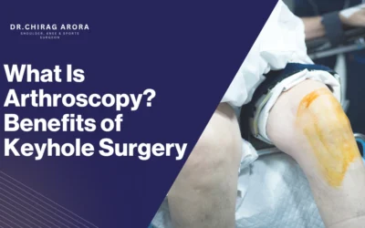 What Is Arthroscopy? Benefits of Keyhole Surgery 