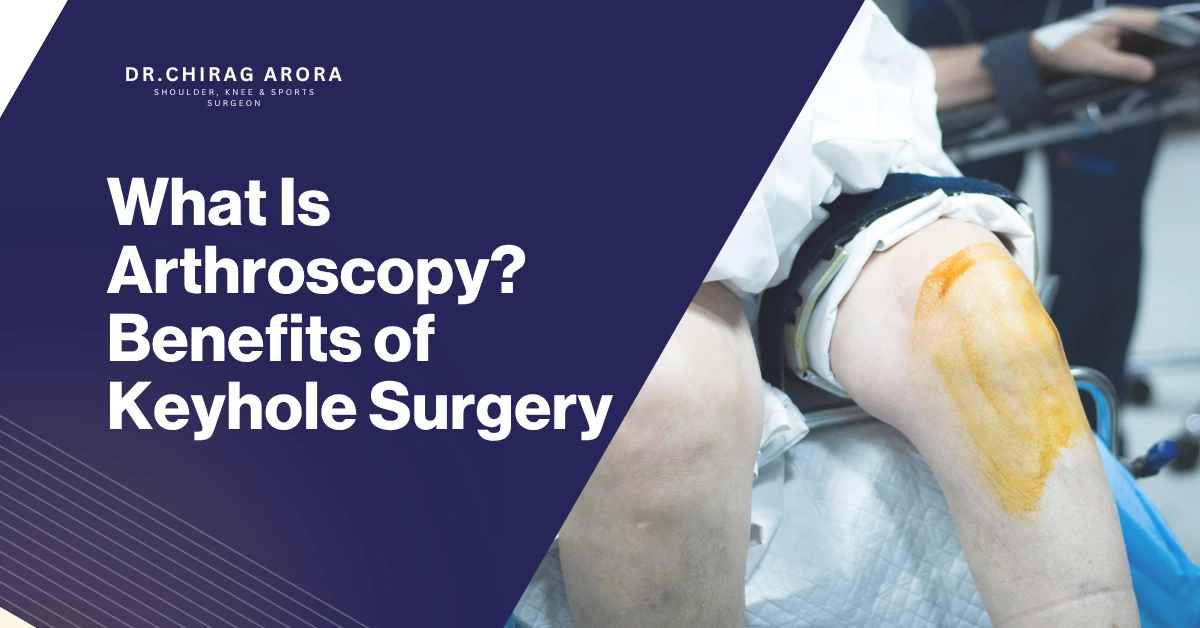Arthroscopy Arthroscopy surgery Keyhole surgery Minimally invasive surgery Joint pain treatment Knee arthroscopy Shoulder arthroscopy Hip arthroscopy Ankle arthroscopy Elbow arthroscopy Wrist arthroscopy Ligament injury treatment ACL tear treatment Meniscus tear surgery Rotator cuff injury treatment Cartilage damage treatment Sports injury treatment Orthopedic surgeon in Gurgaon Joint stiffness treatment Arthroscopic procedure Arthroscopy benefits Faster recovery surgery Pain-free surgery options Joint injury diagnosis Advanced orthopedic treatment Dr Chirag Arora Orthopedic specialist Gurgaon Keyhole joint surgery benefits Minimally invasive orthopedic surgery Arthroscopy recovery time