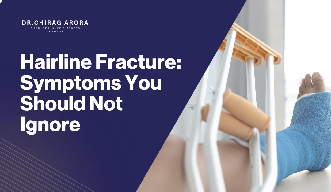 Hairline Fracture: Symptoms You Should Not Ignore