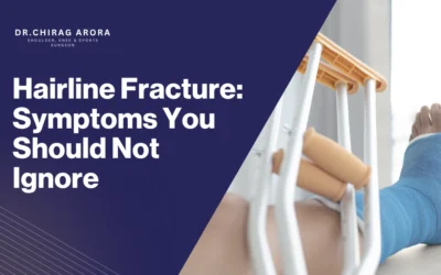 Hairline Fracture: Symptoms You Should Not Ignore