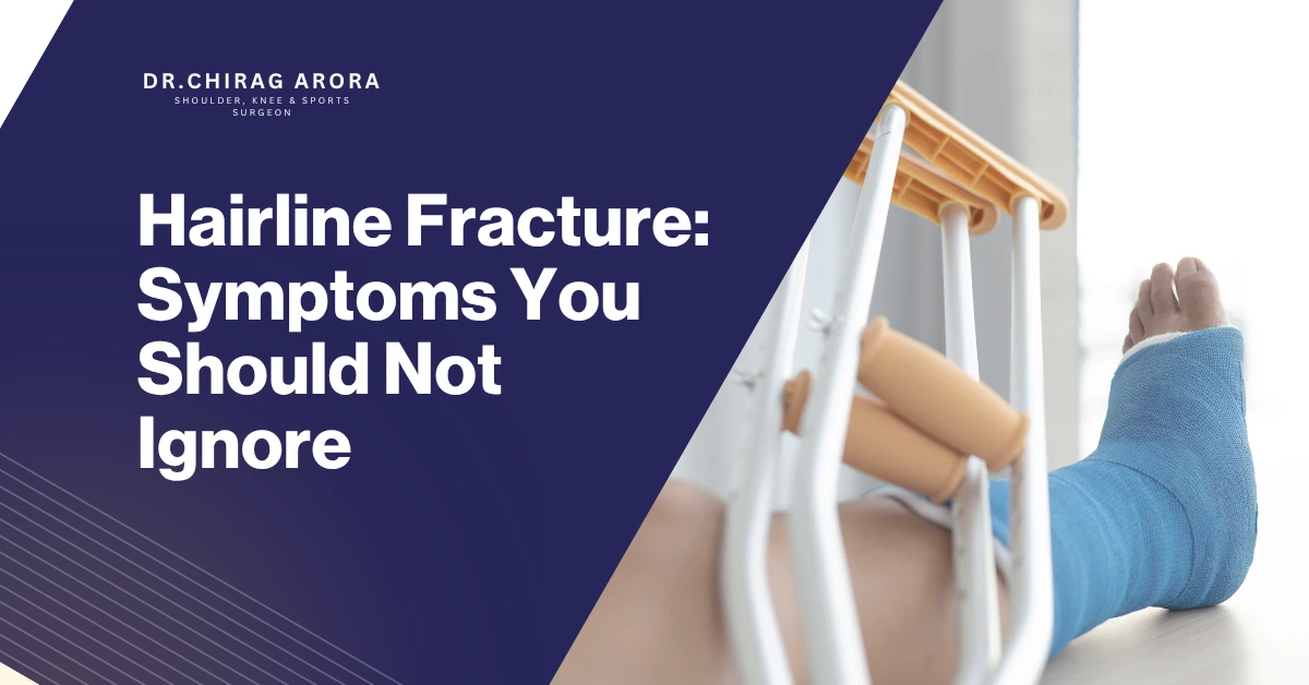 Hairline fracture, Stress fracture, Bone crack symptoms, Hairline fracture pain, Stress fracture in foot, Stress fracture treatment, Bone injury symptoms, Foot pain while walking, Shin pain causes, Ankle stress fracture, Hairline fracture healing time, Bone swelling pain, Bone tenderness, Sports injury fracture, Overuse injury bone, Running injury pain, Vitamin D bone health, Calcium deficiency bone pain, Bone stress injury, Fracture without accident, Small bone fracture, Bone pain during activity, MRI for fracture detection, X-ray negative fracture, Fracture recovery tips, Bone rest and recovery, Athletes bone injury, Joint pain swelling, Early fracture symptoms, Bone injury treatment, Dr. Chirag Arora, Dr Chirag Arora orthopedic doctor, Best orthopedic doctor in Gurgaon, Best shoulder doctor in Gurgaon, Best knee doctor in Gurgaon, Orthopedic specialist Gurgaon, Bone doctor in Gurgaon, Sports injury specialist Gurgaon