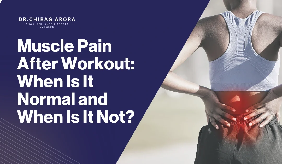 Muscle Pain After Workout: When It Is Normal and When It Is Not