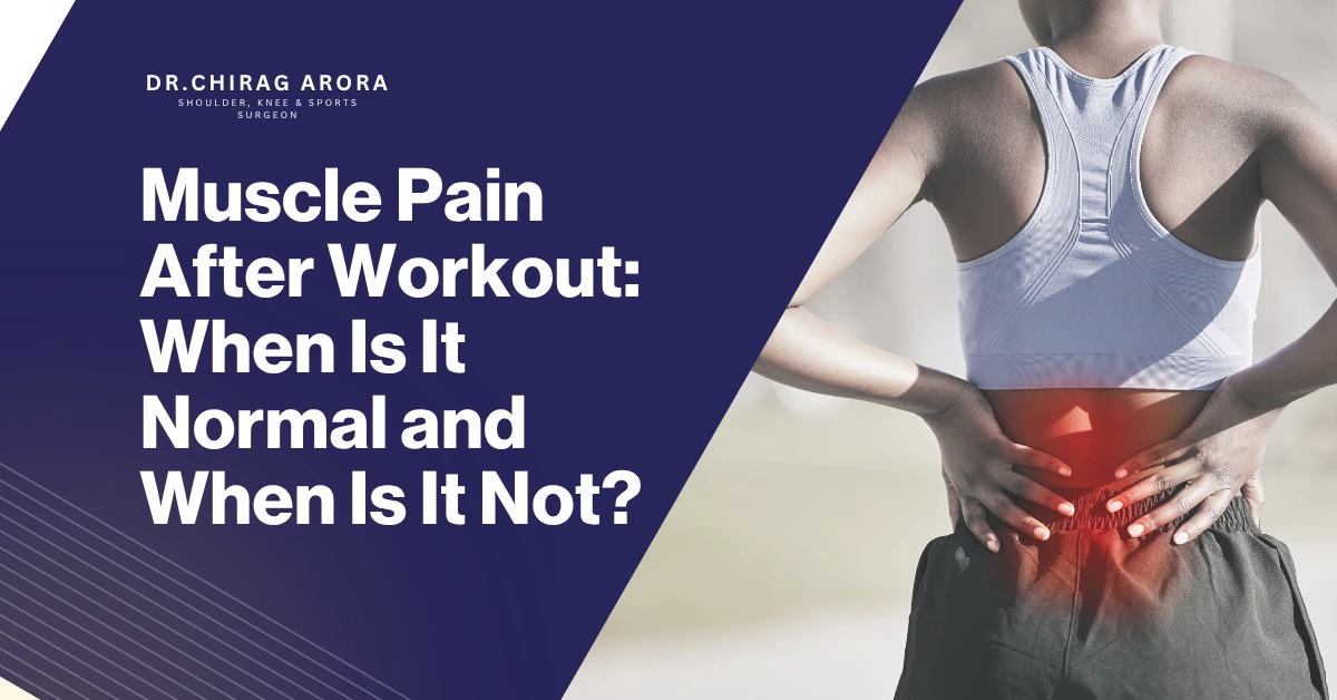 muscle pain after workout, post workout muscle pain, delayed onset muscle soreness (DOMS), muscle soreness after exercise, delayed onset muscle soreness, severe muscle pain after exercise, workout recovery tips, muscle injury symptoms, exercise muscle pain treatment, muscle strain after workout, muscle recovery after exercise, how to reduce muscle soreness, workout pain vs injury, causes of muscle pain after workout, normal muscle soreness after gym, muscle stiffness after exercise, orthopedic treatment for sports injuries, sports injury doctor, exercise recovery methods, muscle fatigue after workout, Dr. Chirag Arora Best Orthopedic, Dr. Chirag Arora, orthopedic doctor in Gurgaon, sports injury doctor Gurgaon