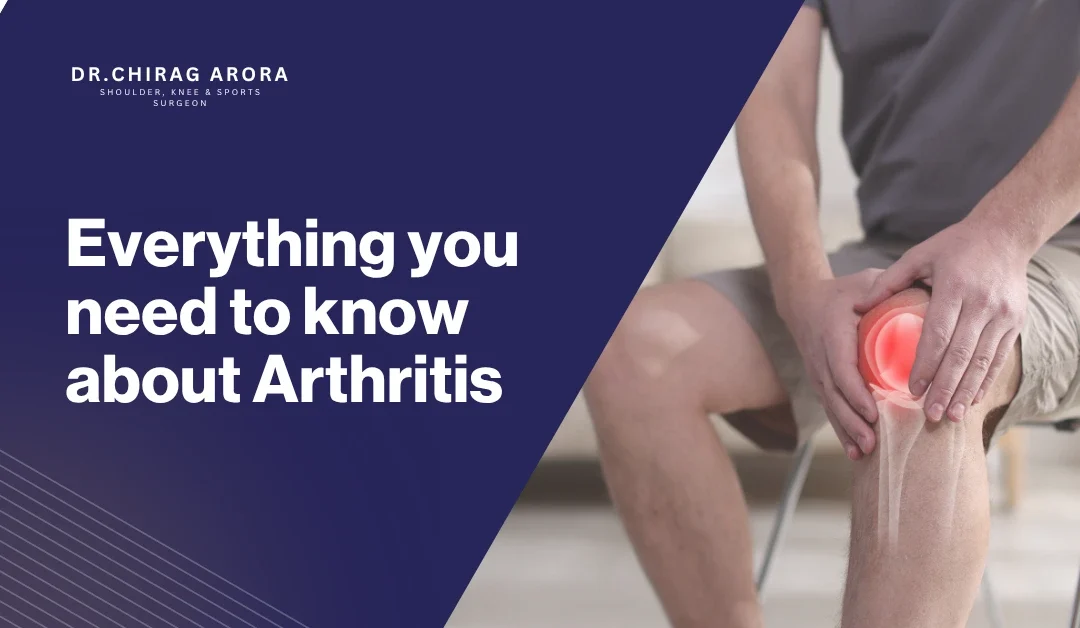 Everything you need to know about Arthritis