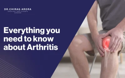 Everything you need to know about Arthritis