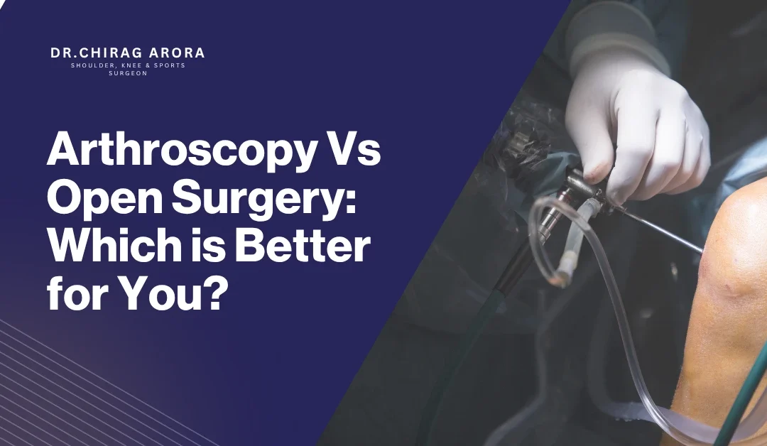 Arthroscopy Vs Open Surgery: Which is Better for You?