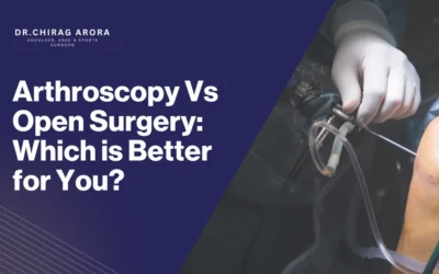 Arthroscopy Vs Open Surgery: Which is Better for You?