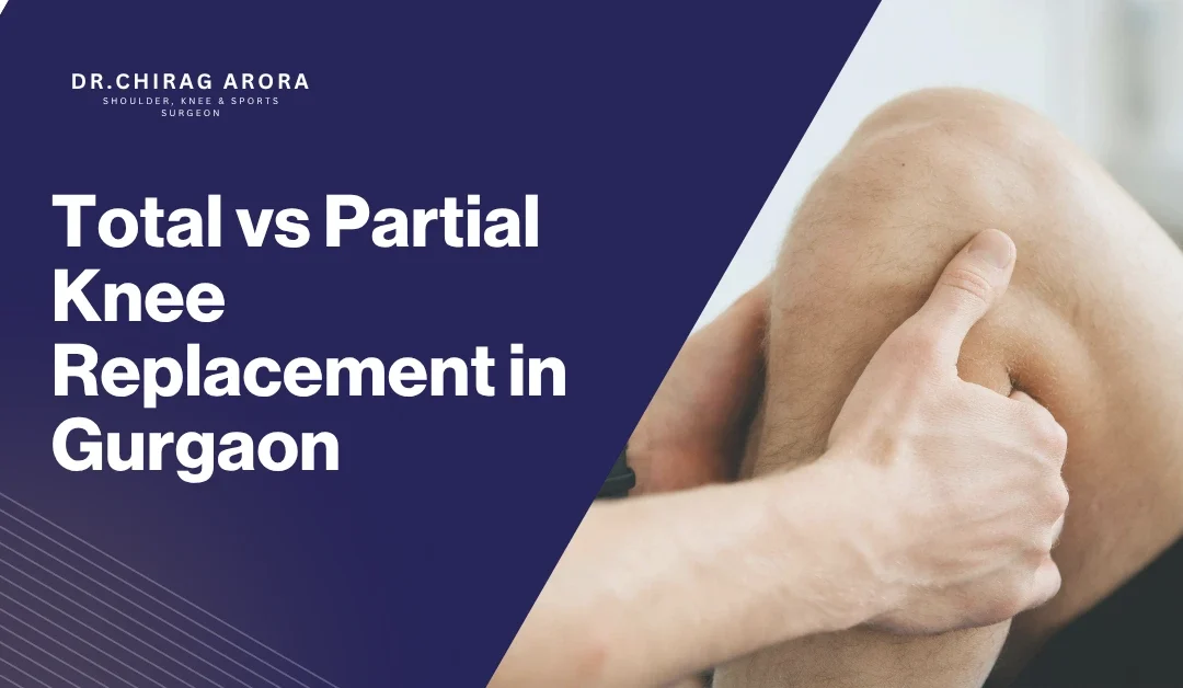Total vs Partial Knee Replacement in Gurgaon