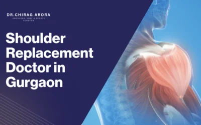 Shoulder Replacement Doctor in Gurgaon