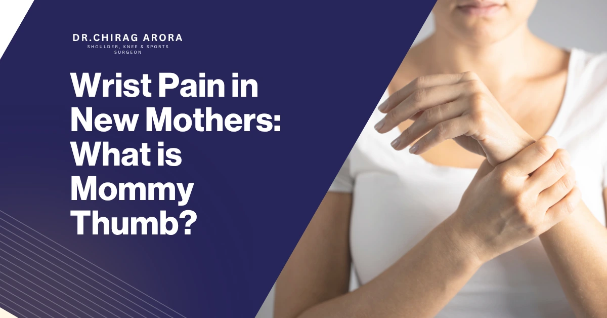 Mommy thumb, wrist pain in new mothers, De Quervain tenosynovitis, thumb pain after delivery, postpartum wrist pain, new mom wrist pain, baby lifting pain, wrist swelling mothers, thumb tendonitis, wrist pain treatment, orthopedic doctor wrist pain, Dr. Chirag Arora, Dr. Chirag Arora Best Orthopedic Surgeon, hand pain after pregnancy, breastfeeding wrist pain, wrist support splint, wrist inflammation, tendon pain thumb, repetitive strain injury wrist, postpartum health issues, mother wrist care, wrist physiotherapy, thumb movement pain, wrist injury treatment, baby care wrist pain, wrist exercises mothers, hand grip pain, orthopedic specialist India, wrist rest tips, motherhood health problems