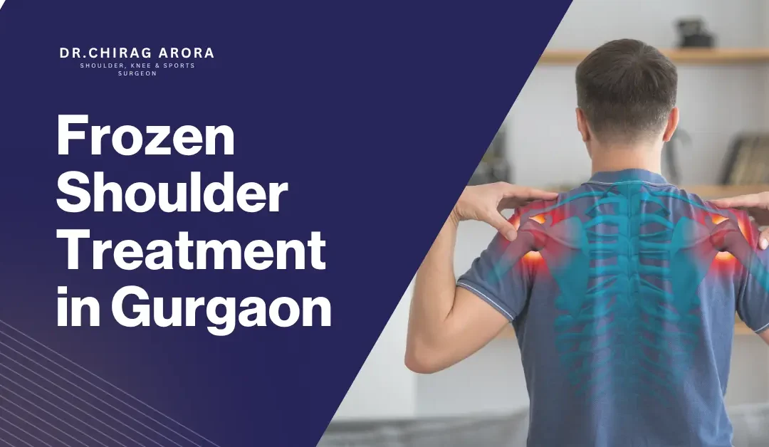 Frozen Shoulder Treatment in Gurgaon – Expert Care with Dr. Chirag Arora