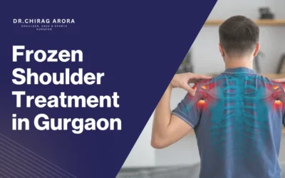 Frozen Shoulder Treatment in Gurgaon – Expert Care with Dr. Chirag Arora