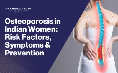 Osteoporosis in Women: What You Need to Know