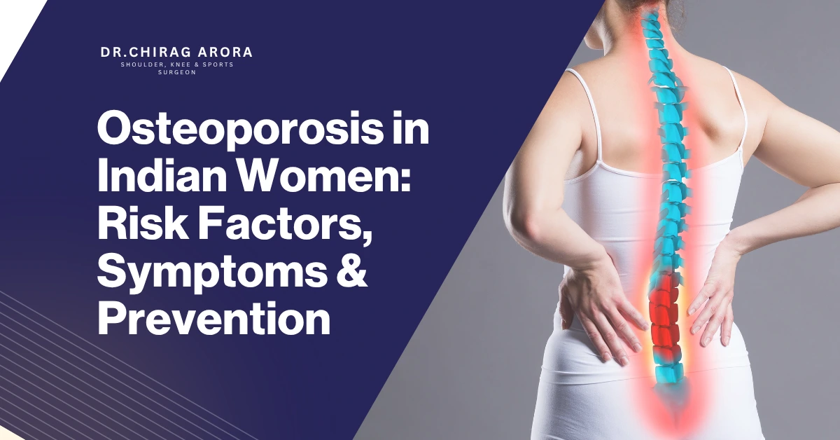 Osteoporosis in Indian women, bone health India, calcium deficiency women, vitamin D deficiency India, weak bones treatment, bone density test, osteoporosis symptoms, fracture risk women, postmenopausal osteoporosis, osteoporosis prevention tips, healthy bones diet, orthopedic doctor India, Dr. Chirag Arora, Dr Chirag Arora Best Orthopedic Surgeon, bone weakness causes, osteoporosis treatment India, women health bones, low calcium symptoms, bone strengthening exercises, joint and bone care, senior women bone health, lifestyle bone health, Indian diet calcium, osteoporosis awareness India, bone fracture prevention, orthopedic consultation India, bone loss treatment, posture correction osteoporosis, early osteoporosis detection, bone strength tips