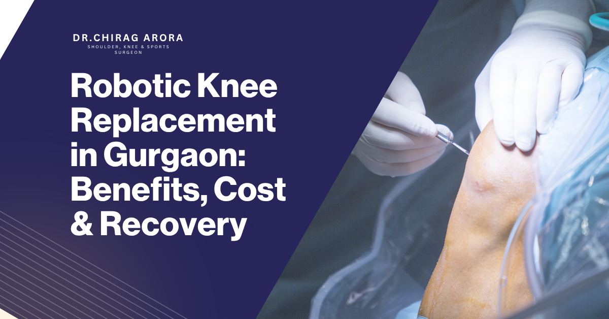 Robotic Knee Replacement in Gurgaon, knee replacement surgery Gurgaon, Dr Chirag Arora, Dr Chirag Arora Best Orthopedic Surgeon, orthopedic surgeon Gurgaon, knee pain treatment, robotic knee surgery India, knee replacement cost Gurgaon, best knee surgeon Gurgaon, joint replacement surgery, arthritis knee treatment, advanced knee surgery, minimally invasive knee replacement, faster recovery knee surgery, knee implant surgery, robotic orthopedic surgery, knee stiffness treatment, knee arthritis doctor Gurgaon, knee replacement recovery, knee surgery benefits, knee replacement hospital Gurgaon, knee replacement specialist India, knee joint pain relief, best orthopedic doctor India, robotic surgery benefits, knee replacement physiotherapy, joint pain treatment Gurgaon, knee replacement success rate, advanced orthopedic care Gurgaon.