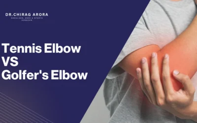 Tennis Elbow vs Golfer’s Elbow