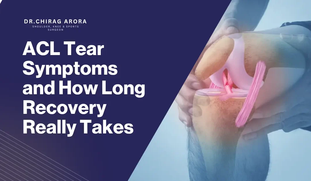ACL Tear Symptoms and How Long Recovery Really Takes