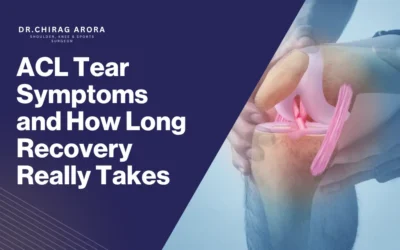 ACL Tear Symptoms and How Long Recovery Really Takes