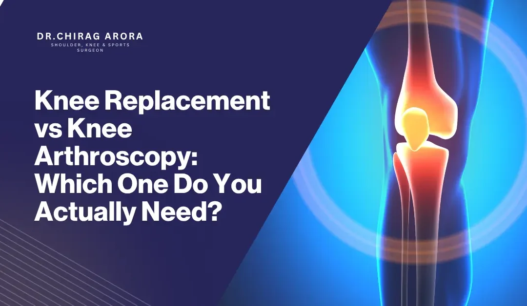 Knee Replacement vs Knee Arthroscopy: Which One Do You Actually Need?