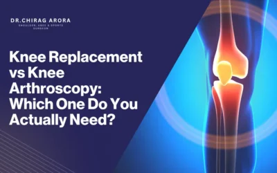Knee Replacement vs Knee Arthroscopy: Which One Do You Actually Need?