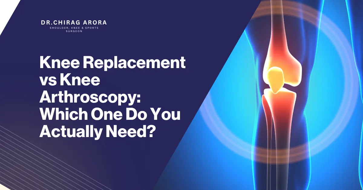 Knee replacement vs knee arthroscopy, knee replacement surgery, knee arthroscopy, knee arthroscopy procedure, arthroscopic knee surgery, total knee replacement, partial knee replacement, knee surgery, best knee surgery, knee pain treatment, knee pain diagnosis, severe knee arthritis, advanced knee osteoarthritis, meniscus tear treatment, ligament injury, cartilage damage, joint replacement surgery, knee replacement recovery, knee arthroscopy recovery, physiotherapy after knee surgery, knee rehabilitation, robotic knee replacement, knee implant, orthopaedic surgeon, minimally invasive knee surgery, treatment for knee arthritis, knee replacement indications, knee locking treatment, non-surgical knee pain treatment, knee treatment options