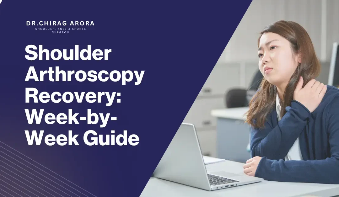 Shoulder Arthroscopy Recovery: Week-by-Week Guide