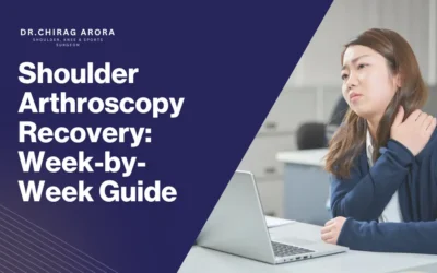 Shoulder Arthroscopy Recovery: Week-by-Week Guide