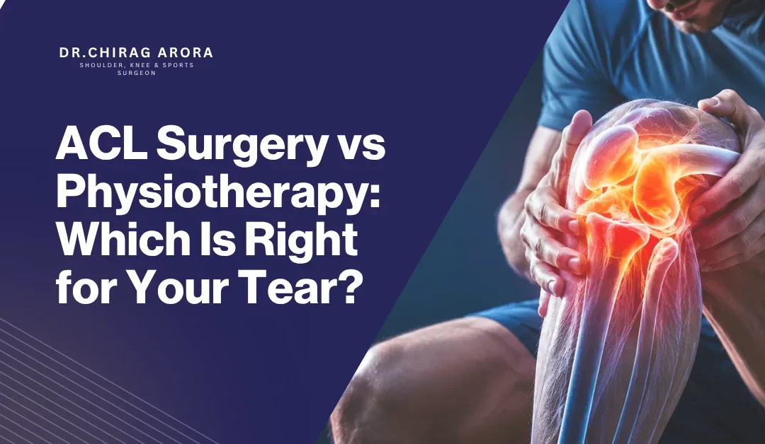 ACL Surgery vs Physiotherapy: Which Is Right for Your Tear?