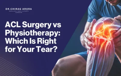 ACL Surgery vs Physiotherapy: Which Is Right for Your Tear?