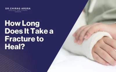 How Long Does It Take a Fracture to Heal?