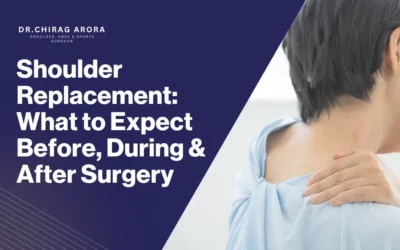 Shoulder Replacement: What to Expect Before, During & After Surgery