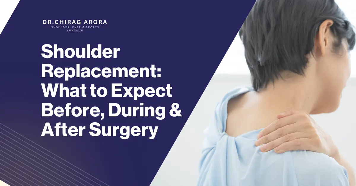 shoulder replacement surgery, shoulder replacement surgery in Gurgaon, shoulder replacement surgeon Dr Chirag Arora in Gurgaon, Dr Chirag Arora best shoulder replacement surgeon in Gurgaon, shoulder replacement recovery, shoulder replacement recovery time, shoulder replacement procedure, shoulder replacement treatment, total shoulder replacement, reverse shoulder replacement, reverse shoulder replacement surgery, shoulder arthroplasty, shoulder arthritis treatment, severe shoulder pain treatment, shoulder joint replacement, shoulder surgery in Gurgaon, orthopaedic surgeon in Gurgaon, best orthopaedic surgeon in Gurgaon, shoulder specialist Dr Chirag Arora in Gurgaon, shoulder pain specialist in Gurgaon, shoulder replacement physiotherapy, exercises after shoulder replacement, shoulder replacement benefits, shoulder replacement risks, shoulder replacement surgery cost, recovery after shoulder replacement surgery, shoulder replacement for arthritis, shoulder replacement for rotator cuff damage, shoulder replacement for fracture, when is shoulder replacement needed